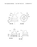 METHODS AND DEVICES FOR IMPROVING EFFICACY OF NON-INVASIVE VENTILATION diagram and image