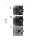 Automated Image Data Subtraction System Suitable for Use in Angiography diagram and image