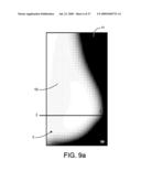 Method and Apparatus for Processing Digital Mammographic Images diagram and image