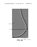 Method and Apparatus for Processing Digital Mammographic Images diagram and image