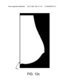 Method and Apparatus for Processing Digital Mammographic Images diagram and image