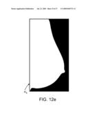 Method and Apparatus for Processing Digital Mammographic Images diagram and image