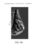 Method and Apparatus for Processing Digital Mammographic Images diagram and image