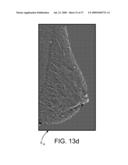 Method and Apparatus for Processing Digital Mammographic Images diagram and image