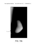 Method and Apparatus for Processing Digital Mammographic Images diagram and image