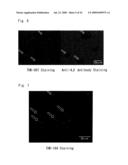 DIAGNOSTIC PROBE FOR CONFORMATION DISEASE diagram and image