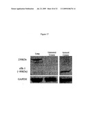 sVEGFR-2 AND ITS ROLE IN LYMPHANGIOGENESIS MODULATION diagram and image