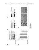 Methods of Inhibiting Tumor Cell Aggressiveness Using The Microenvironment of Human Embryonic Stem Cells diagram and image