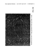 Anti-neoplastic compositions comprising extracts of black cohosh diagram and image