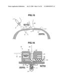 MEDICAL DEVICE AND PROCESS OF INSTALLING MEDICAL DEVICE IN PATIENT diagram and image