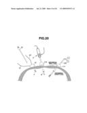 MEDICAL DEVICE AND PROCESS OF INSTALLING MEDICAL DEVICE IN PATIENT diagram and image