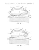 EPICARDIAL ACCESS AND TREATMENT SYSTEMS diagram and image