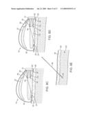 EPICARDIAL ACCESS AND TREATMENT SYSTEMS diagram and image