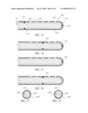 ANTI-MICROBIAL CATHETER diagram and image