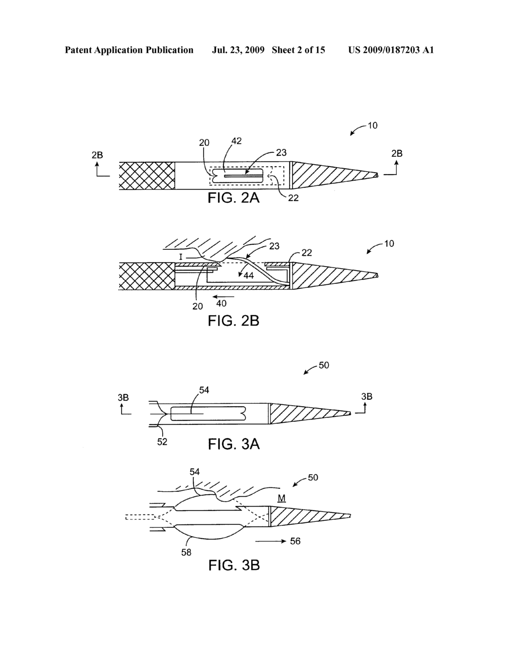 APPARATUS AND METHODS FOR MATERIAL CAPTURE AND REMOVAL - diagram, schematic, and image 03