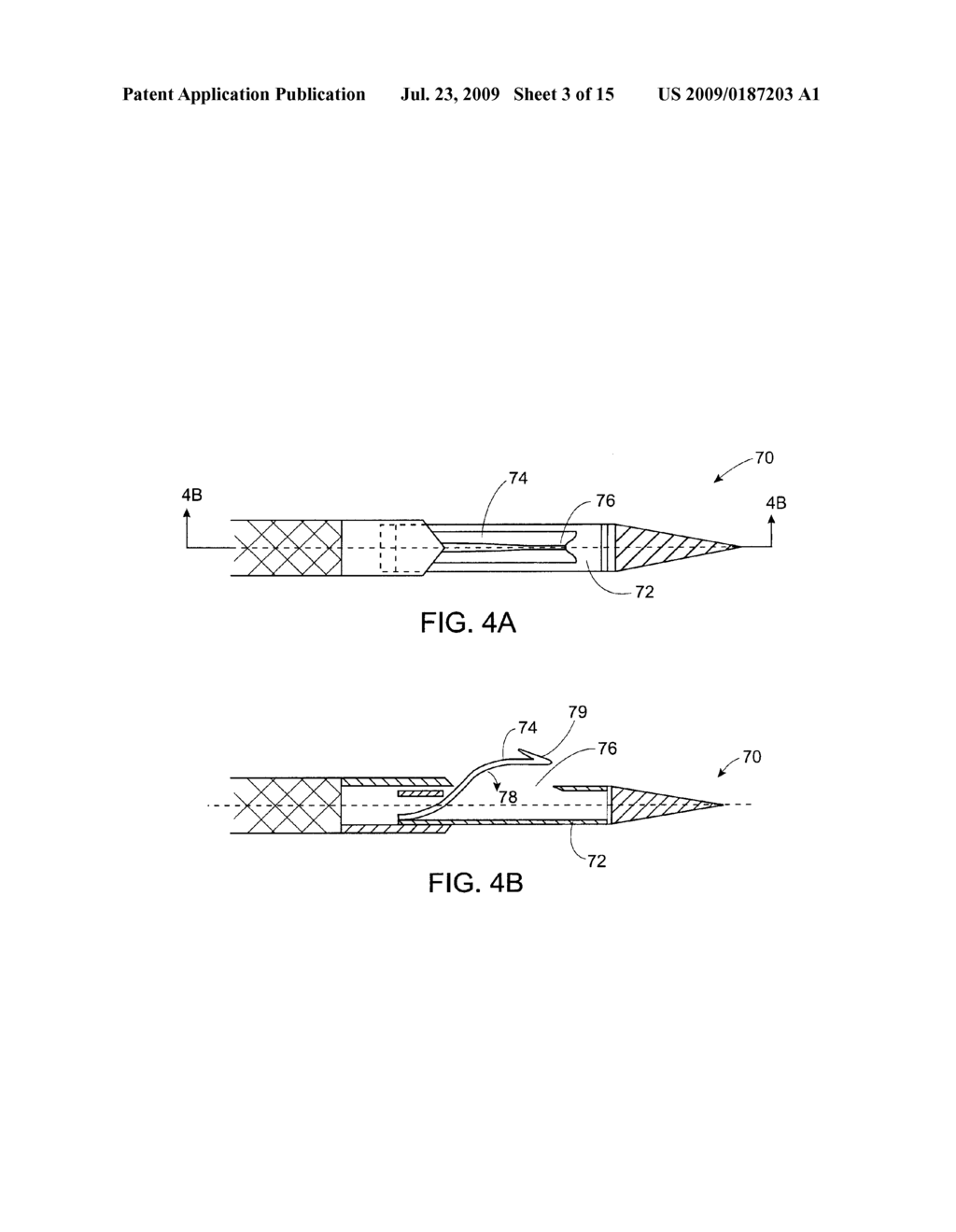 APPARATUS AND METHODS FOR MATERIAL CAPTURE AND REMOVAL - diagram, schematic, and image 04