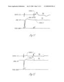 AUTOCAPTURE PACING/SENSING CONFIGURATION diagram and image