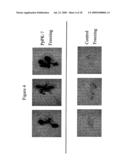 Protein Kinase Stress-Related Proteins and Methods of Use in Plants diagram and image