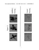 Protein Kinase Stress-Related Proteins and Methods of Use in Plants diagram and image