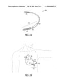 METHOD AND APPARATUS FOR RADIATION EFFECTS DETECTION diagram and image