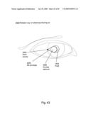 Systems Using Eye Mounted Displays diagram and image