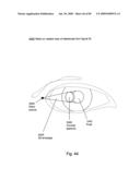 Systems Using Eye Mounted Displays diagram and image