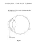 Systems Using Eye Mounted Displays diagram and image