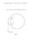 Systems Using Eye Mounted Displays diagram and image