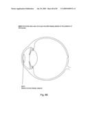 Systems Using Eye Mounted Displays diagram and image