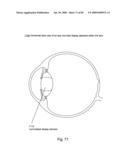 Systems Using Eye Mounted Displays diagram and image