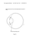 Systems Using Eye Mounted Displays diagram and image