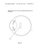 Systems Using Eye Mounted Displays diagram and image