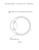 Systems Using Eye Mounted Displays diagram and image