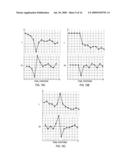 Gauge monitoring methods, devices and systems diagram and image