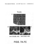Combination of FcgammaRIIB-Specific Antibodies and CD20-Specific Antibodies and Methods of Use Thereof diagram and image
