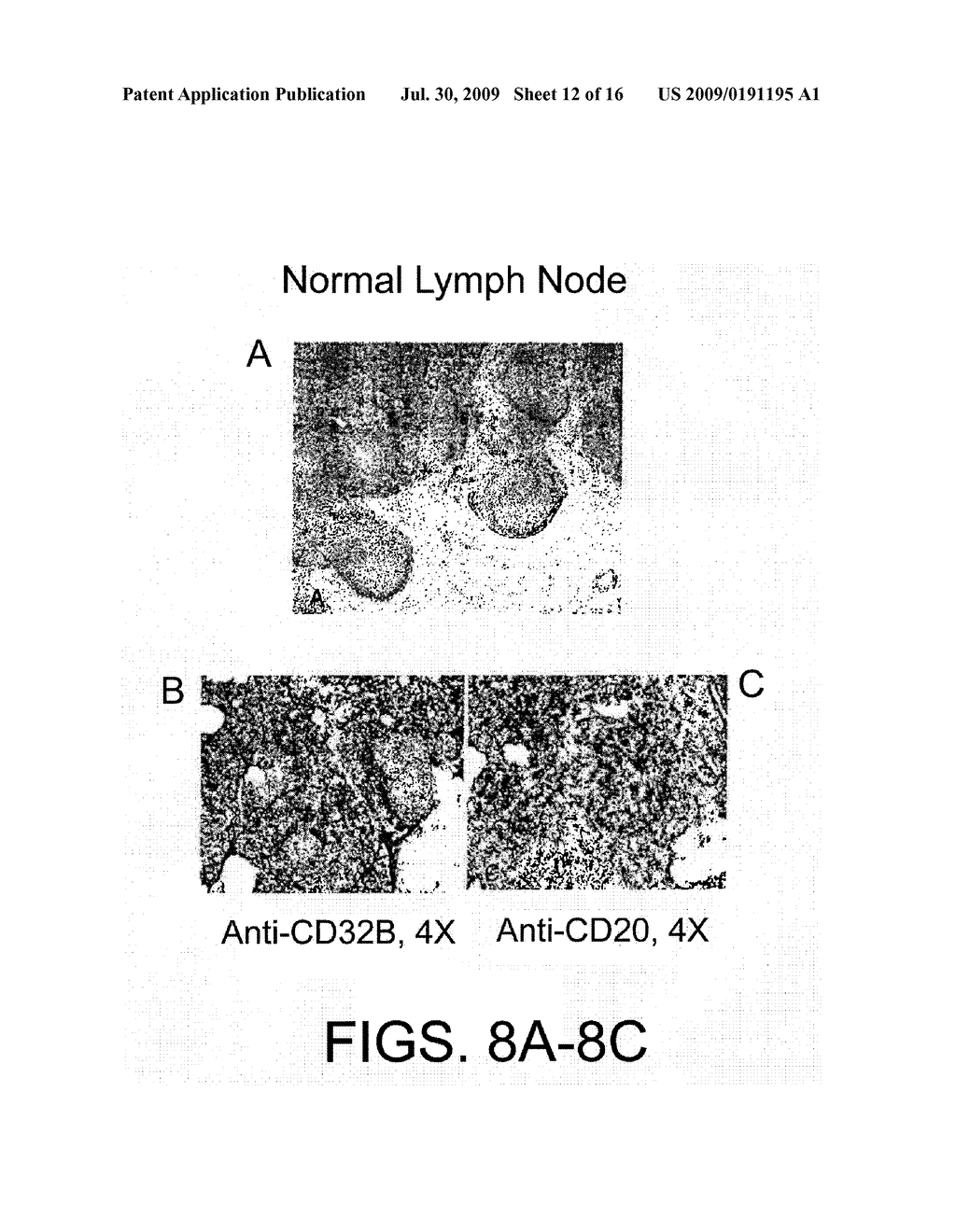 Combination of FcgammaRIIB-Specific Antibodies and CD20-Specific Antibodies and Methods of Use Thereof - diagram, schematic, and image 13