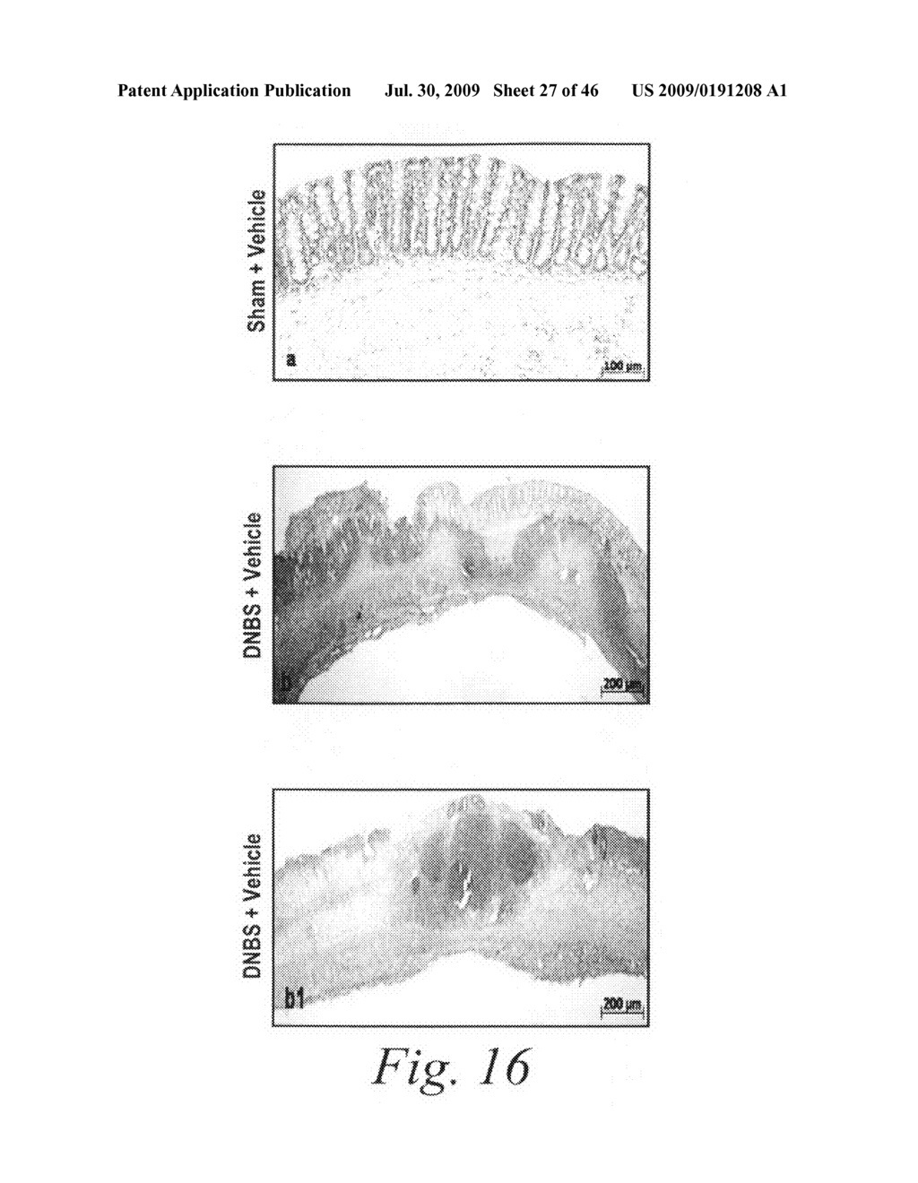 Antibodies against flagellin and uses thereof - diagram, schematic, and image 28