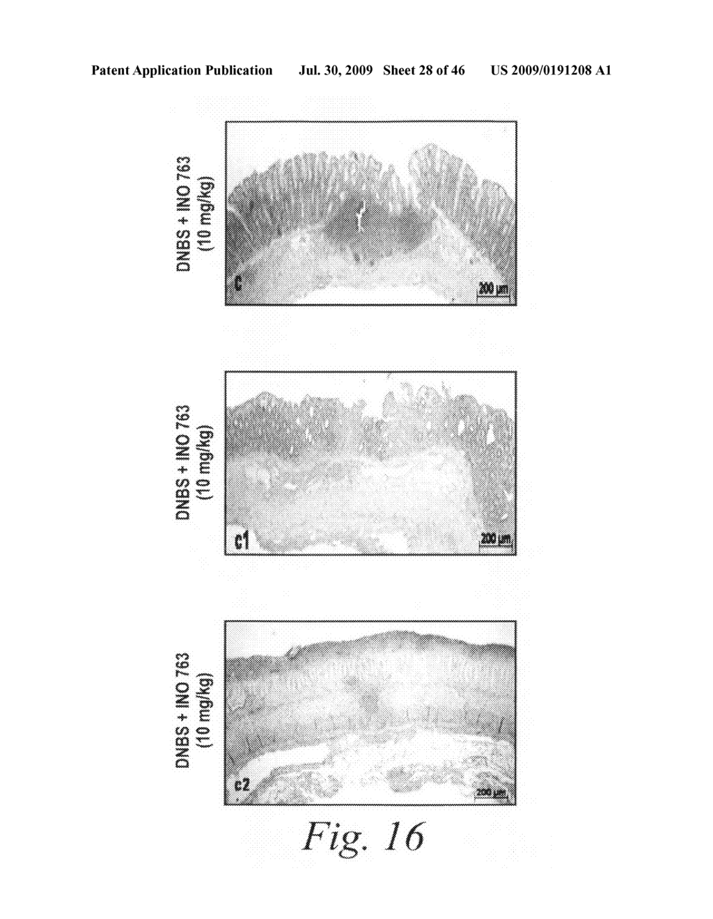 Antibodies against flagellin and uses thereof - diagram, schematic, and image 29