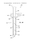 INSUFFLATING ACCESS SYSTEM diagram and image