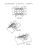 SYSTEMS FOR CONTROLLED CLOSURE OF BODY LUMENS diagram and image