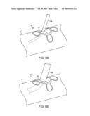 SYSTEMS FOR CONTROLLED CLOSURE OF BODY LUMENS diagram and image