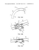 SYSTEMS FOR CONTROLLED CLOSURE OF BODY LUMENS diagram and image