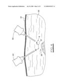 Parietal anchoring tool and device, in particular for laparoscopic or coelioscopic surgery diagram and image