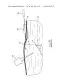 Parietal anchoring tool and device, in particular for laparoscopic or coelioscopic surgery diagram and image