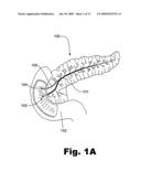 METHODS AND SYSTEMS OF TREATING ISCHEMIA PAIN IN VISCERAL ORGANS diagram and image