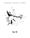 METHODS AND SYSTEMS OF TREATING ISCHEMIA PAIN IN VISCERAL ORGANS diagram and image