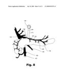 METHODS AND SYSTEMS OF TREATING ISCHEMIA PAIN IN VISCERAL ORGANS diagram and image