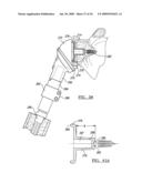 Shoulder Implant Assembly diagram and image
