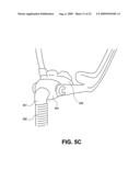 CPAP INTERFACE AND BACKUP DEVICES diagram and image