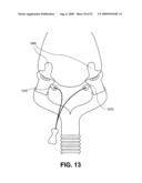 CPAP INTERFACE AND BACKUP DEVICES diagram and image